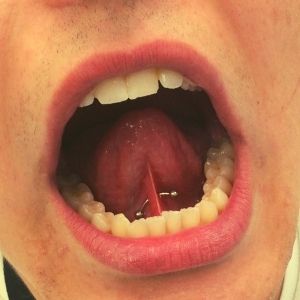 piercing frenillo de lengua de acero